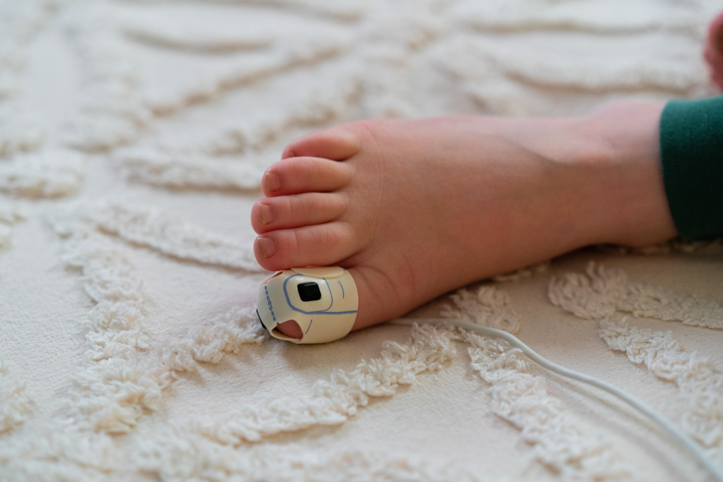 A child wearing a pulse oximeter on his toe as part of a Snap Diagnostics home sleep apnea test